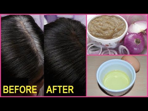 onion paste for gray hair 